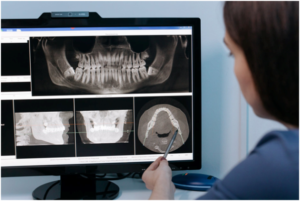 ct-scans